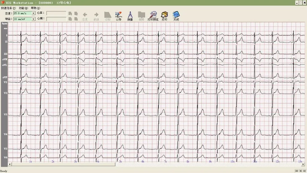 CONTEC 8000 ECG WORKSTATION WINDOWS XP DRIVER CONTEC 8000 ECG WORKSTATION TREIBER HERUNTERLADEN