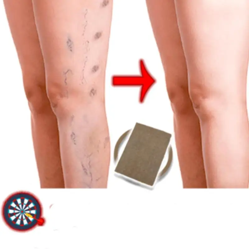 3Pcs/Lot Spider Veins Varicose Treatment Plaster Varicose Veins Cure Patch Vasculitis Natural Solution Herbal Patches