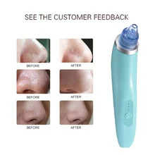 Вакуумный отсос для угрей, Алмазное Удаление угрей, пилинг для пор, уход за кожей лица