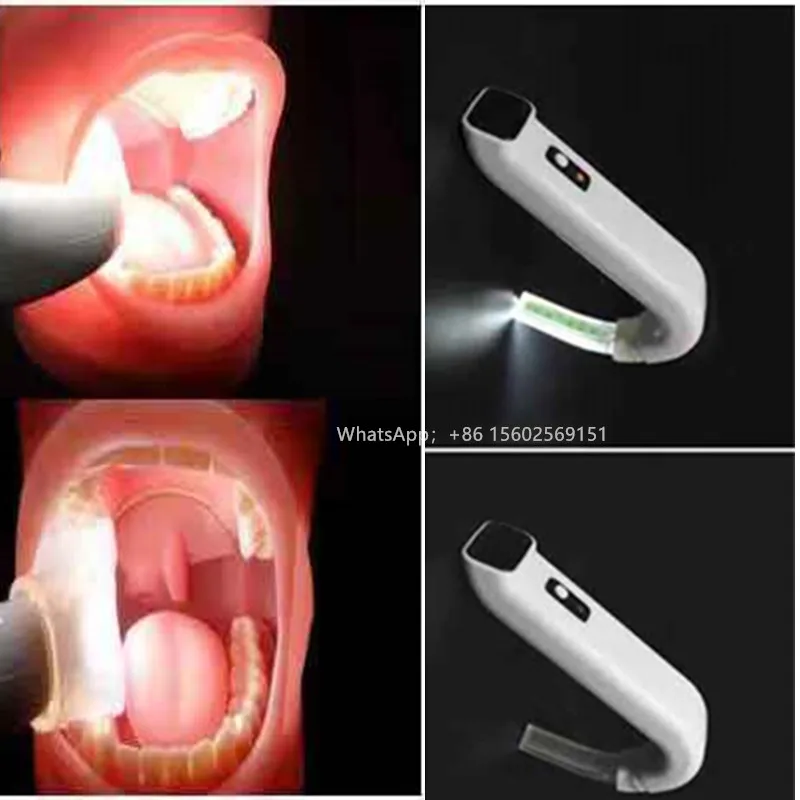 Стоматологический интраоральный светильник с всасыванием беспроводной светодиодный светильник Syetem интраоральный светодиодный светильник для гигиены полости рта