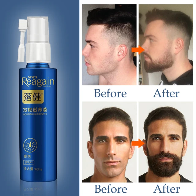 Beard Growth Oil Hair Growth Agent Thickener Hair Beard Care Product