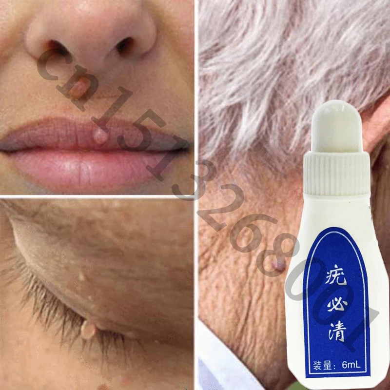 2_ffb524e4-48e1-4e6c-afb4-8cfcebef120d_720x