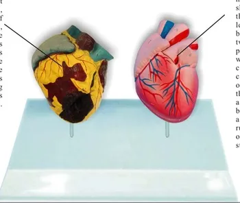 

Smoke heart and normal heart Compare model Medical teaching model free shipping