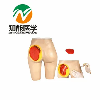 

BIX-H4T Advanced Anatomical Structure Hip Muscle Injection Model G048