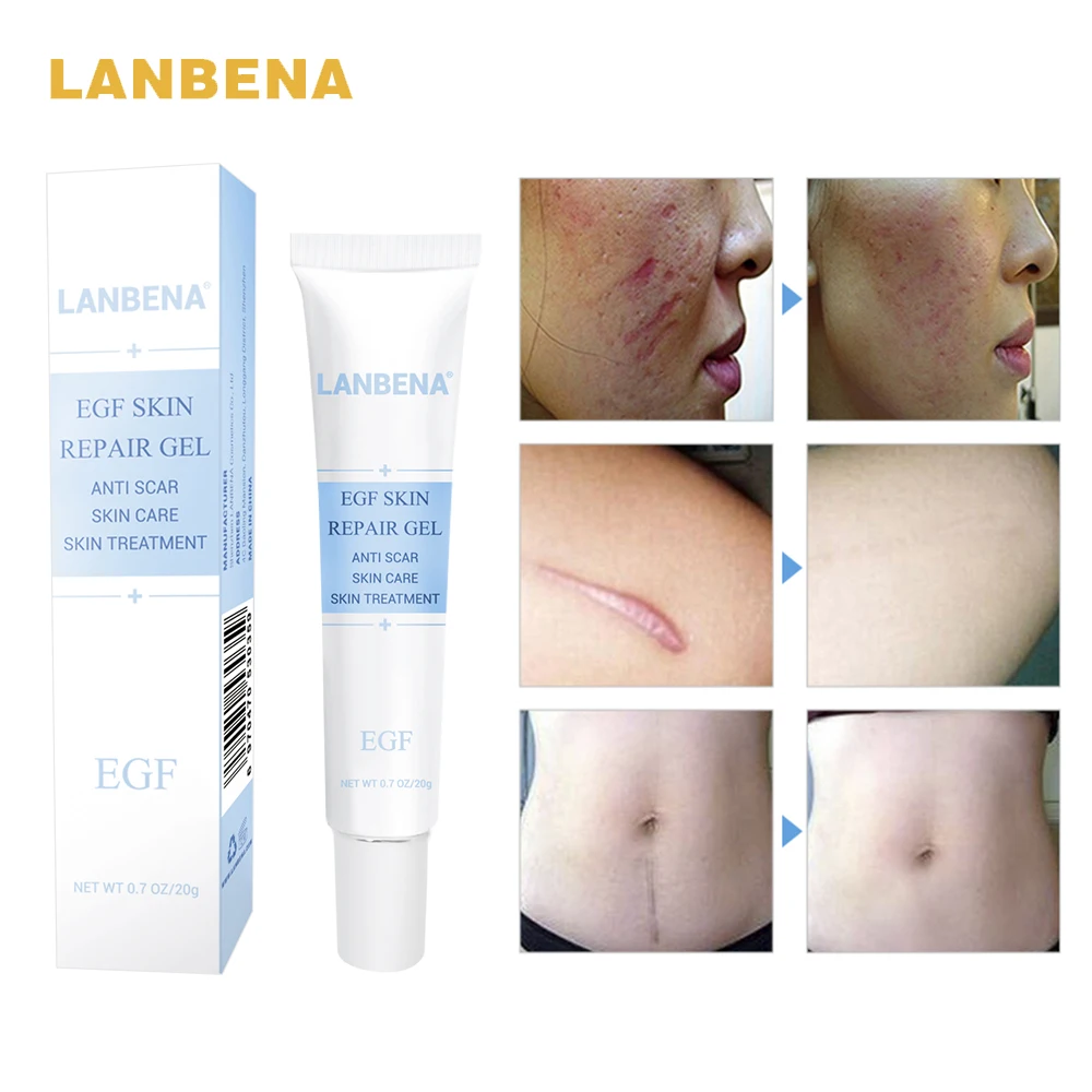 

LANBENA EGF Serum Remover Scar Cream Acne Treatment Whitening Skin Care Stretch Marks Anti Acne Cream Repair Face Cream