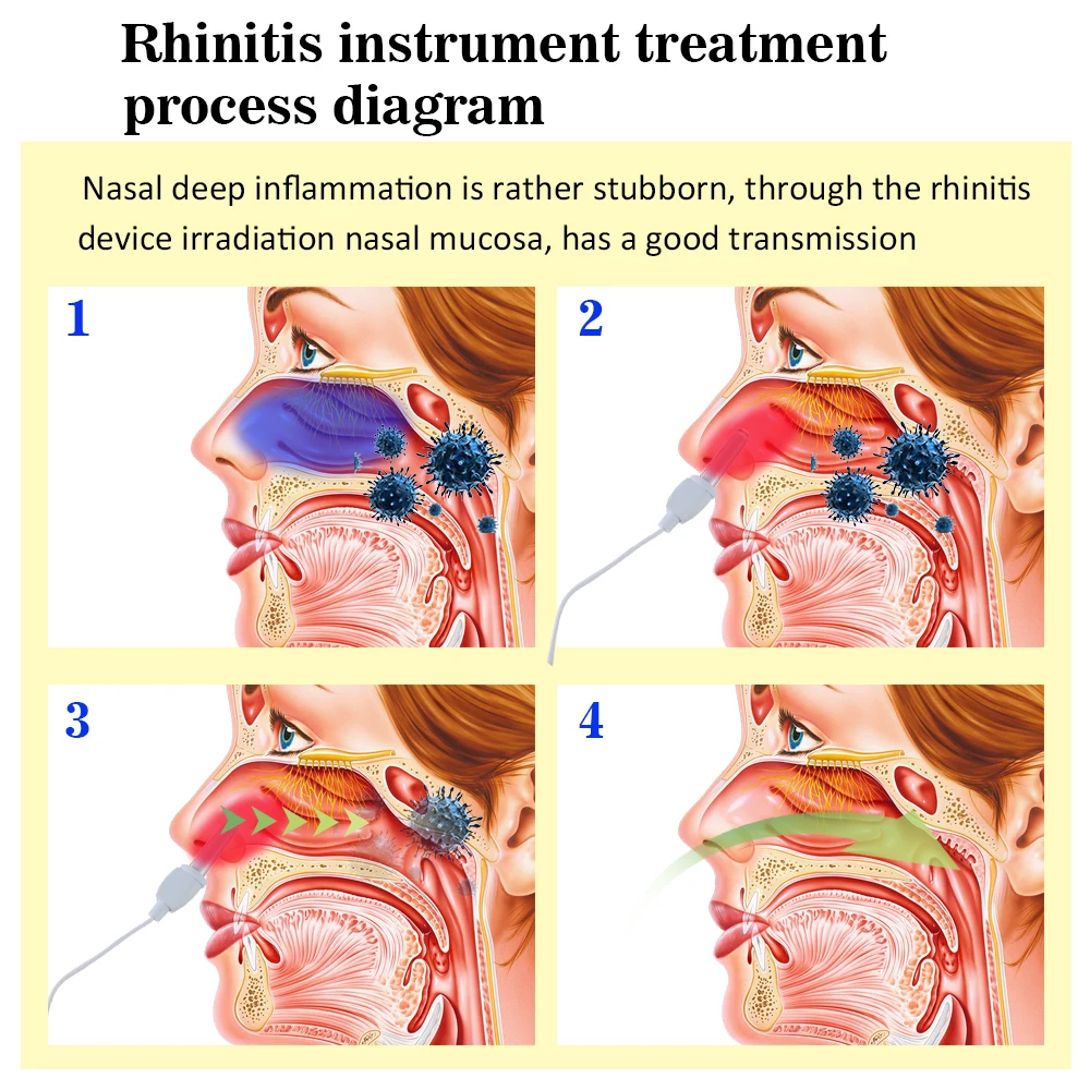 Инструмент для очистки носа Домашний медицинский аппарат ринит аппарат лазерный терапевтический инфракрасный многофункциональный массажер