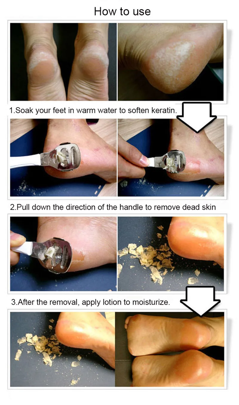 1 шт. ножная терка для ступней, профессиональные педикюрные инструменты, пилка для ног, удаление мозолей, лезвие для ног, средство для удаления кутикулы, бритва
