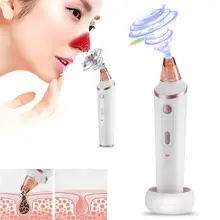 Удаление прыщей угрей, Электрический угрей, вакуумное всасывание Удаление пор для лица, беспроводной очиститель кожи, черный