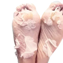 2Pairs Milk Vinegar Remove Dead Skin Baby Foot Mask Skin Smooth Exfoliating Feet Mask Foot Care Socks For Pedicure Socks