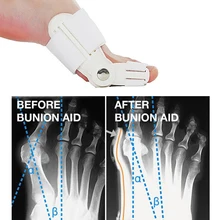 1 Pair Toe Straightener Bunion Splint Movable, Protection and Correction for Feet Affected By Hallux Valgus, Foot care Tool