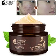 Крем для отбеливания, удаления красоты кожи уход за лицом кремы травяной крем от акне анти прыщей пятна акне шрамы Угри прыщи Treament