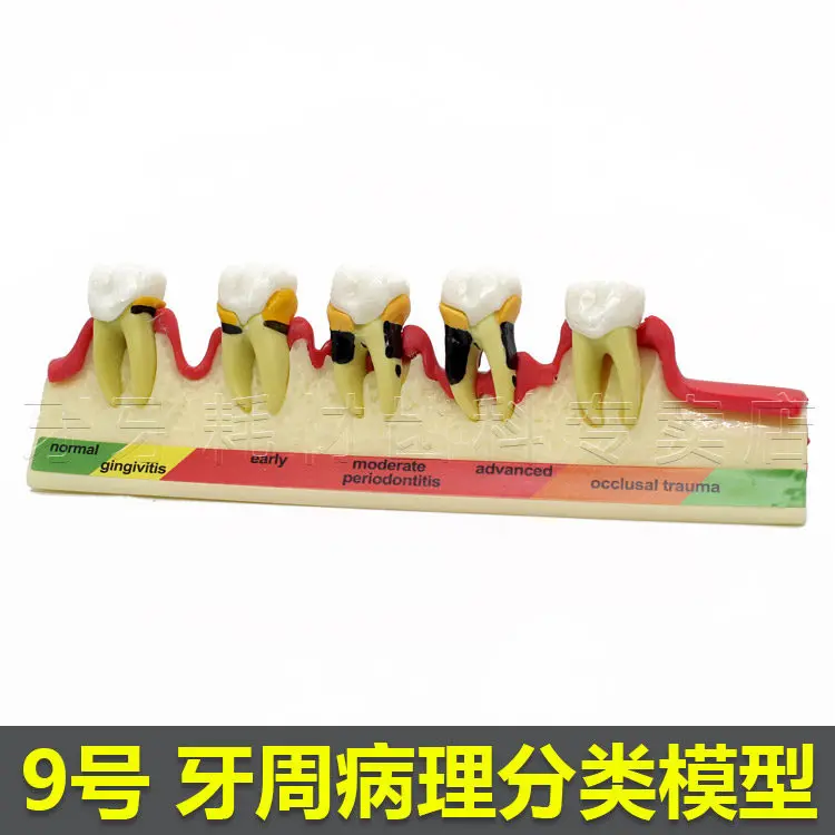 

Dental Periodontal Disease Assort Tooth Typodont Model 1pc