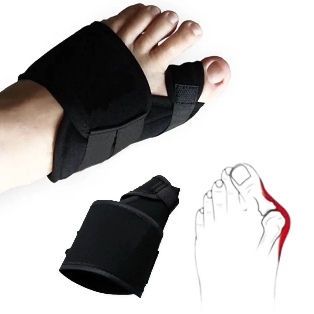 1Pair Daily Orthotic Big Toe Bunion Device Splint Straightener Hallux 