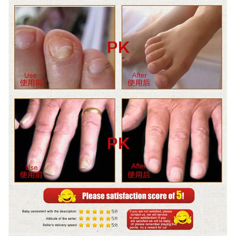 Fungal Nail Treatment Essence Nail and Foot Whitening for Cuticle Oil Toe Nail Fungus Removal Nail Care Makeup