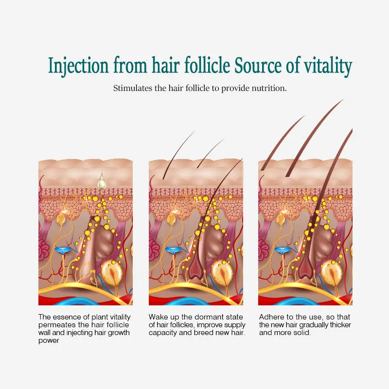 ARTISCARE быстро мощные средства с эссенцией для рост волос Эфирное Масло жидкое лечение Предотвращение выпадения волос уход за волосами Andrea 20 мл