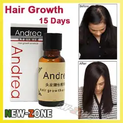 Быстрое решение для роста волос жидкость для всех типов выпадения волос 20 мл для лечения волос 100% натуральный травяной здоровый