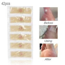 42 шт./компл., ухаживает за кожей стоп наклейки медицинский пластырь куриный глаз мозолей патчи облегчение боли Callus Удаление Уход за ногами бородавки мазь паста