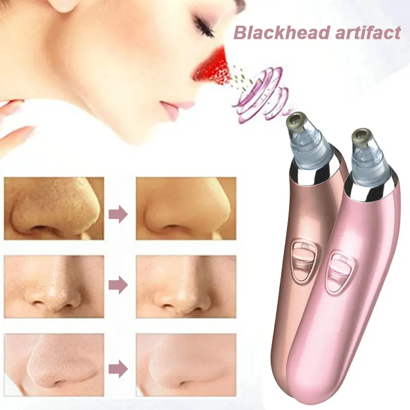 Электрический инструмент для удаления акне точка Noir Blackhead вакуумный экстрактор