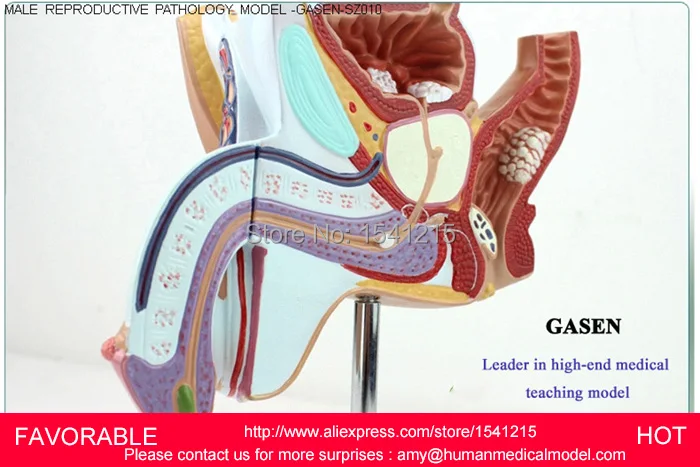 MALE REPRODUCTIVE SYSTEM MODEL ANATOMY OF THE MALE REPRODUCTIVE,MALE REPRODUCT,MALE GENITOURINARY PATHOLOGY MODEL-GASEN-SZ010 MALE REPRODUCTIVE SYSTEM MODEL ANATOMY OF THE MALE REPRODUCTIVE,MALE REPRODUCT,MALE GENITOURINARY PATHOLOGY MODEL-GASEN-SZ010