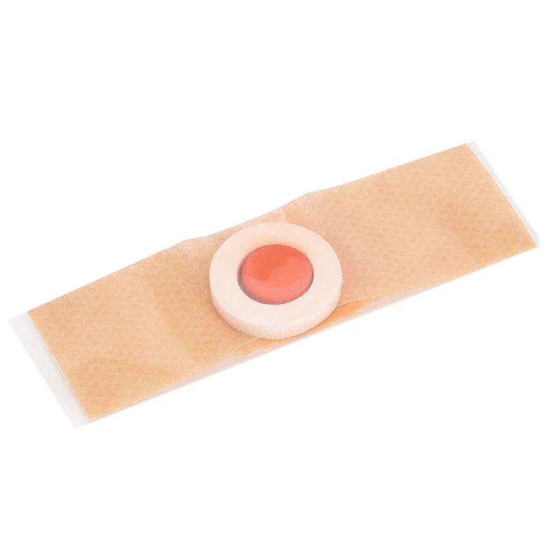 12 pcs القدم الرعاية الطبية الجص القدم الذرة إزالة النسيج أخمصي الثآليل شوكة الجص الرعاية الصحية ل القدم الذرة