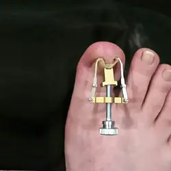 Unha encravada вросших ногтей ногти коррекции восстановить Педикюр Уход за ногами инструмент Бурсит большого пальца стопы ногтей Fixer Ortopedia