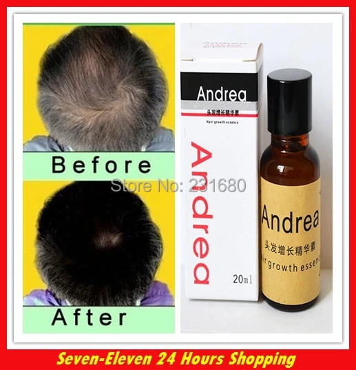 Hot Sale Andrea Hair Fast Growth Essence Oil Hair Loss Liquid ...