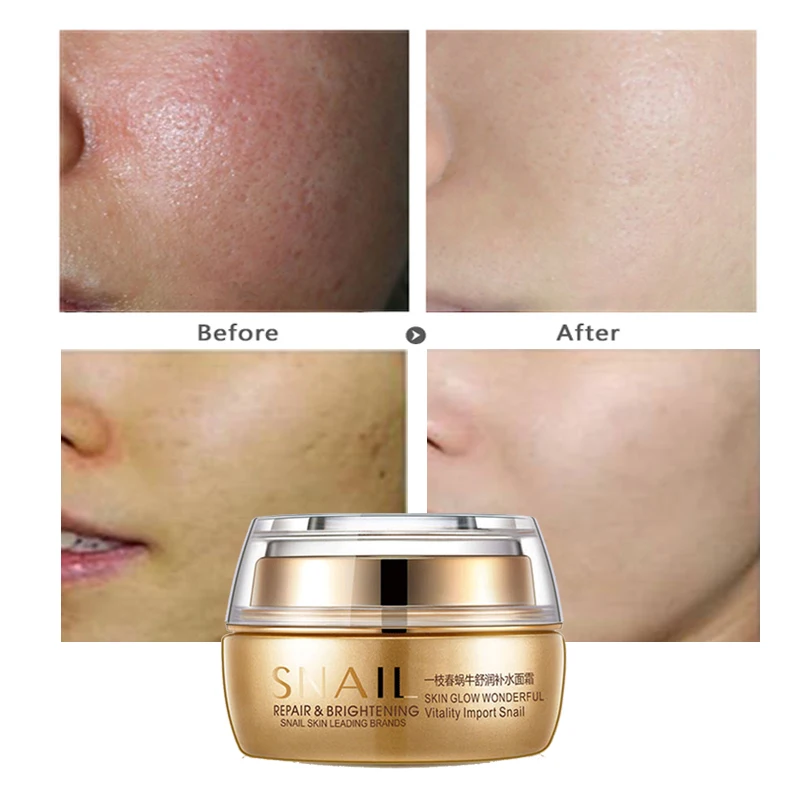 Freckle removing whitening Aliexpress.com : Buy Moisturizing Face Cream Remove Age Spot Scar