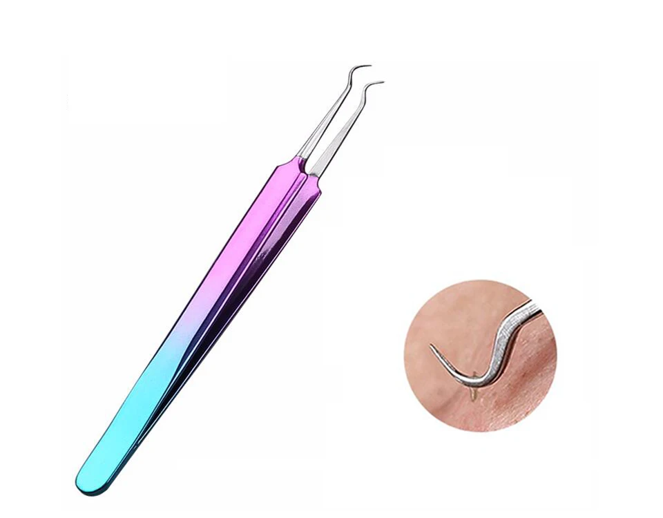 Acne tweezers (1)