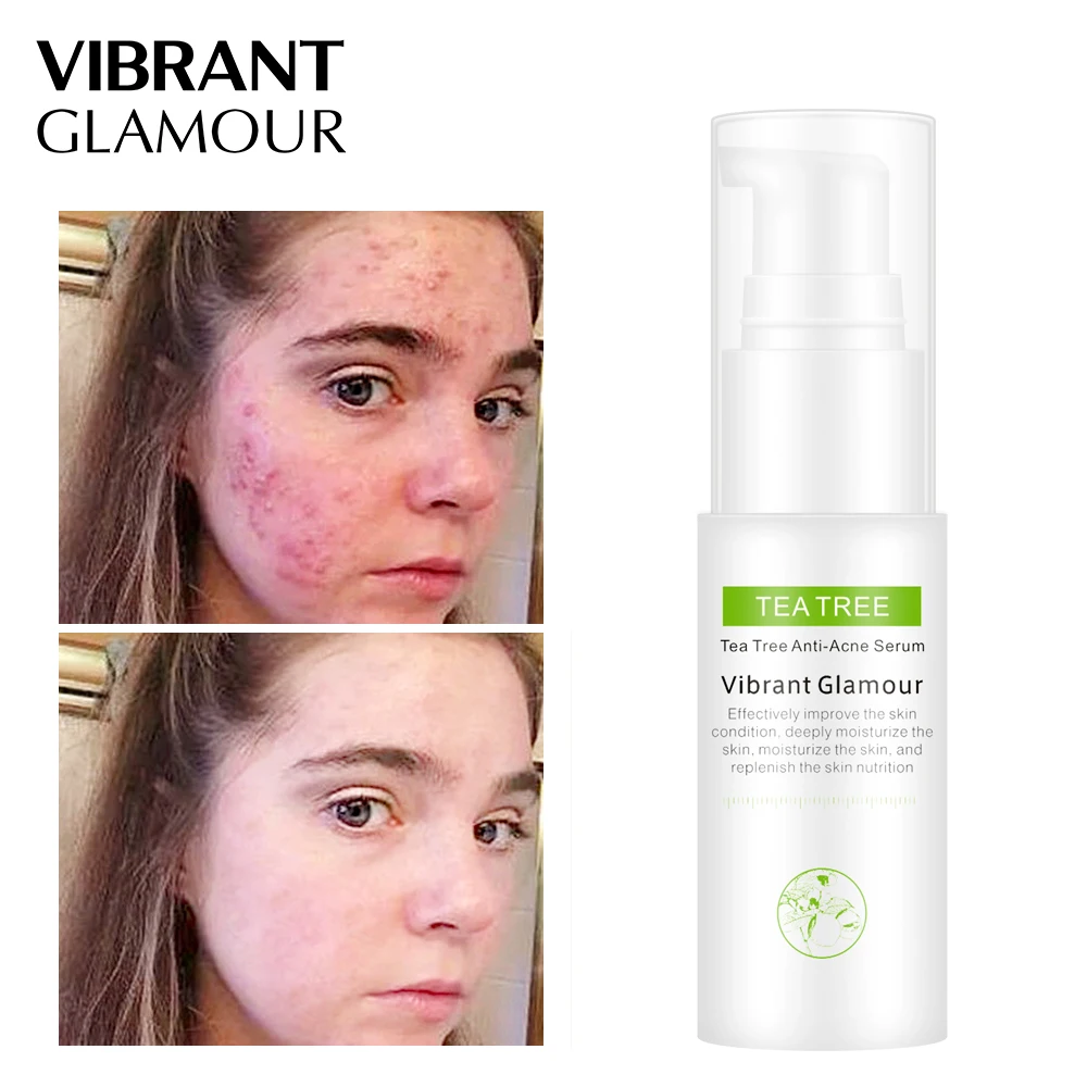 

VIBRANT GLAMOUR Tea Tree Oil Acne Treatment Face Serum Anti Acne Scar Removal Shrink Pores Cream Whitening Anti-Aging Skin Care