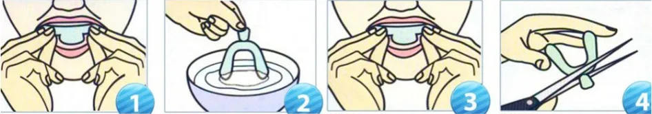 牙托使用步骤
