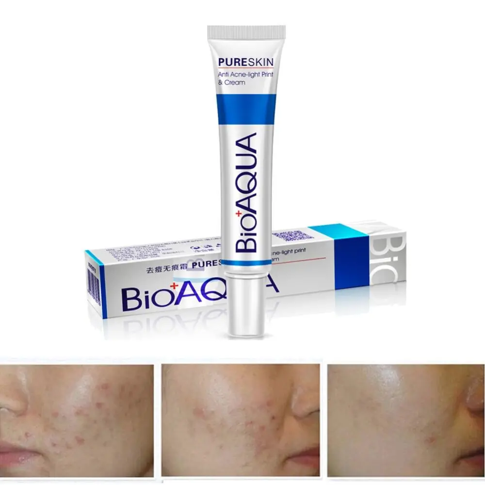 BIOAQUA Skin Care Acne Treatment Face Care Acne Scars Cream Anti Acne