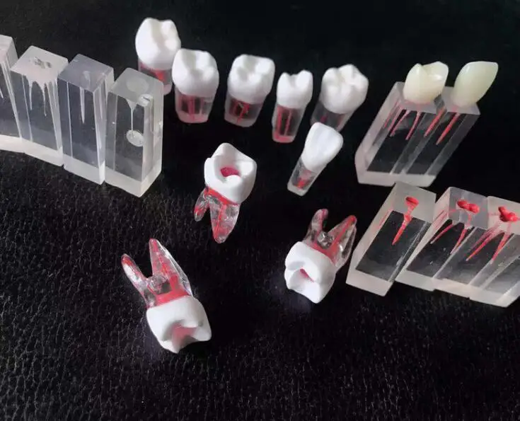 Dental material root canal with root canal resin with granules for treatment of open pulp cavity pulp examination