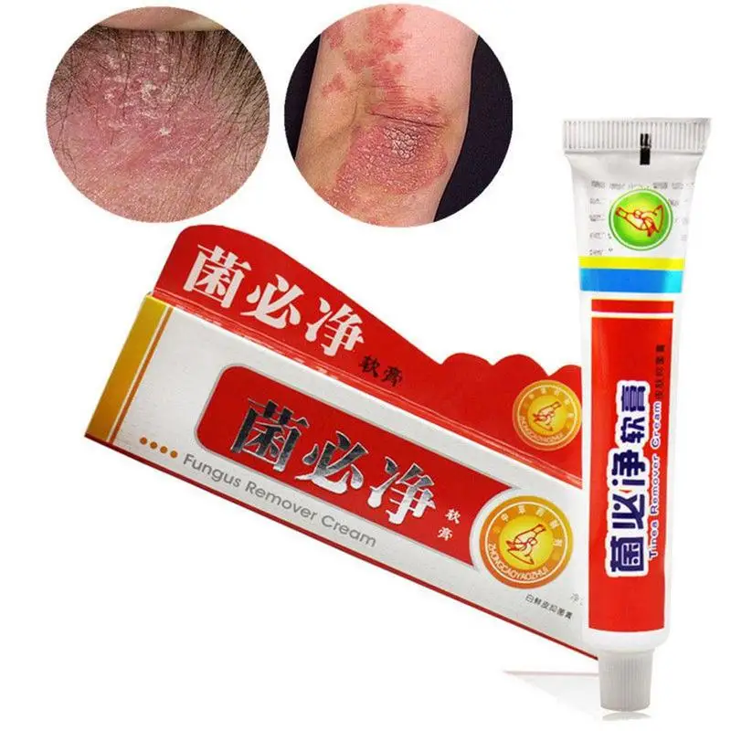 25g de la Psoriasis Dermatitis crema de Eczema de la inflamación de la piel erupción picazón en la piel seca de cuidado de los pies ZVV7576 25g de la Psoriasis Dermatitis crema de Eczema de la inflamación de la piel erupción picazón en la piel seca de cuidado de los pies ZVV7576