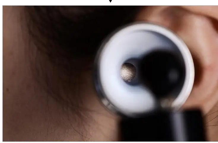 Ушной эндоскоп в ухо светильник зарядка ушной светильник отоскоп ребенок держит светильник количество ушей