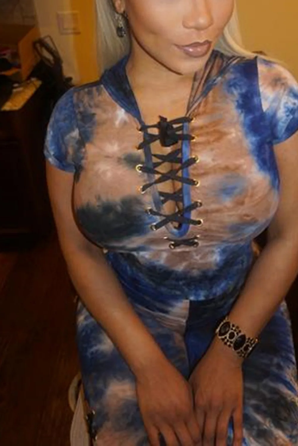 (17)