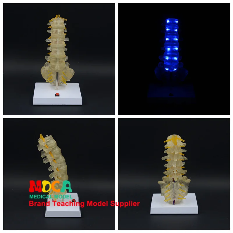 Spine model Luminous ornaments A birthday present Caudal vertebrae Human lumbar spine model Medical teaching equipment Skeleton