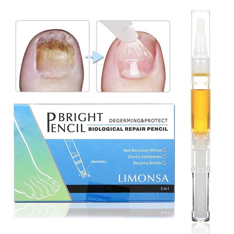 

Nail Toenail Fungus Treatments Effective Nails Fungus Fingernails Cuticle Oil Nails Care Solution Tool