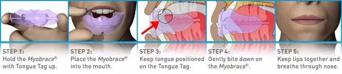 a2instructions