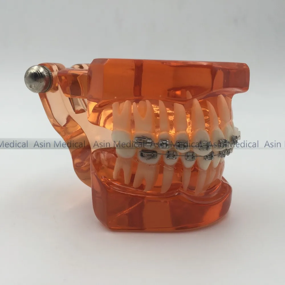 Modelo de Ortodontistas com Metal Dentista de Metal Alta Qualidade Novo Suportes Cerâmicos Ortopedia Paciente Estudante Aprendizagem Modelo 2020 & 10 High Quality Beleza e saúde