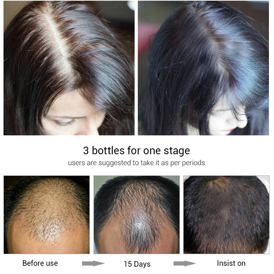 EFERO Hair Growth Serum Essence Hair Loss Product Hair Care Growth Serum Beard Essence Beard Growth Treatment 20ml