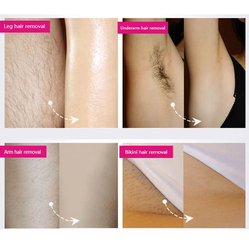 Bikini line on How to