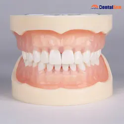 Зубные Стандартный мягкие десны модель с 28 Scew-в зубах/зубы зубной модели M8015