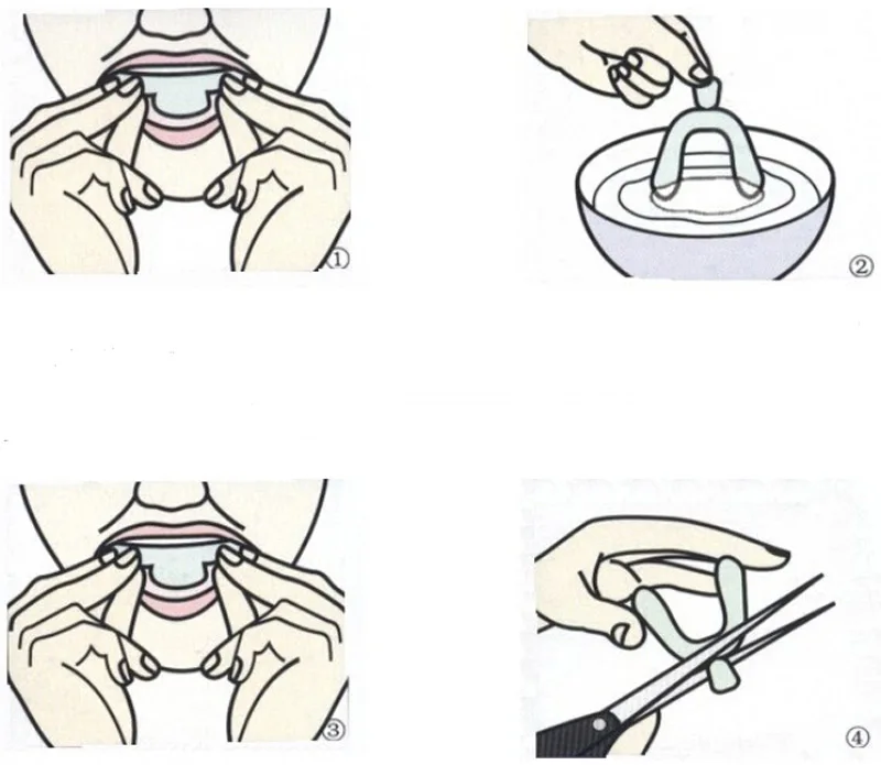 3 шт. инструменты для защиты отлитого рта, термоформа для отбеливания зубов, отбеливающие формы, лотки для ванной