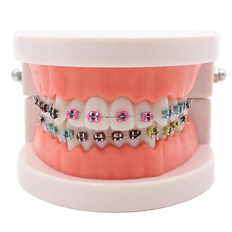 

Dental Orthodontic Treatment Model With Ortho Metal Ceramic Bracket Arch Wire Buccal Tube Ligature Ties Dental Tools Teeth Model