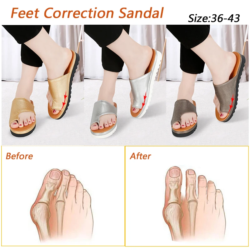 

Women's PU leather shoes thick bottom Ladies Casual Soft Big Toe Correction Sandal Orthopedic Bunion Corrector semi-slip Shoes