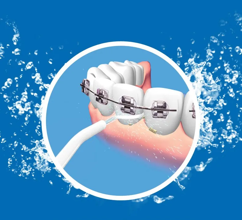 Ороситель для полости рта ирригация воды Чистка зубов удобный уход за зубами без электричества бесшумный предотвращает разложение зубов