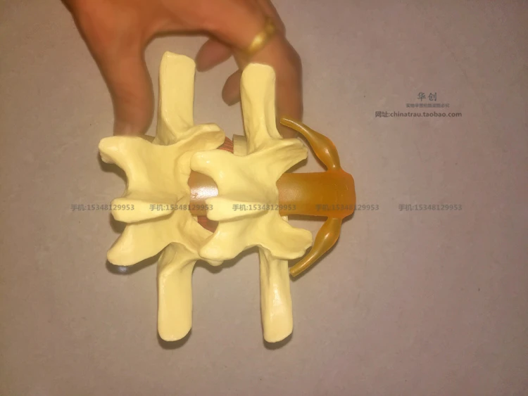 Медицинский Поясничный позвонок модель поражения нормальном состоянии CMAM VERTEBRA12 в натуральную величину поясничного модели позвонков в 3 этапа вырождения