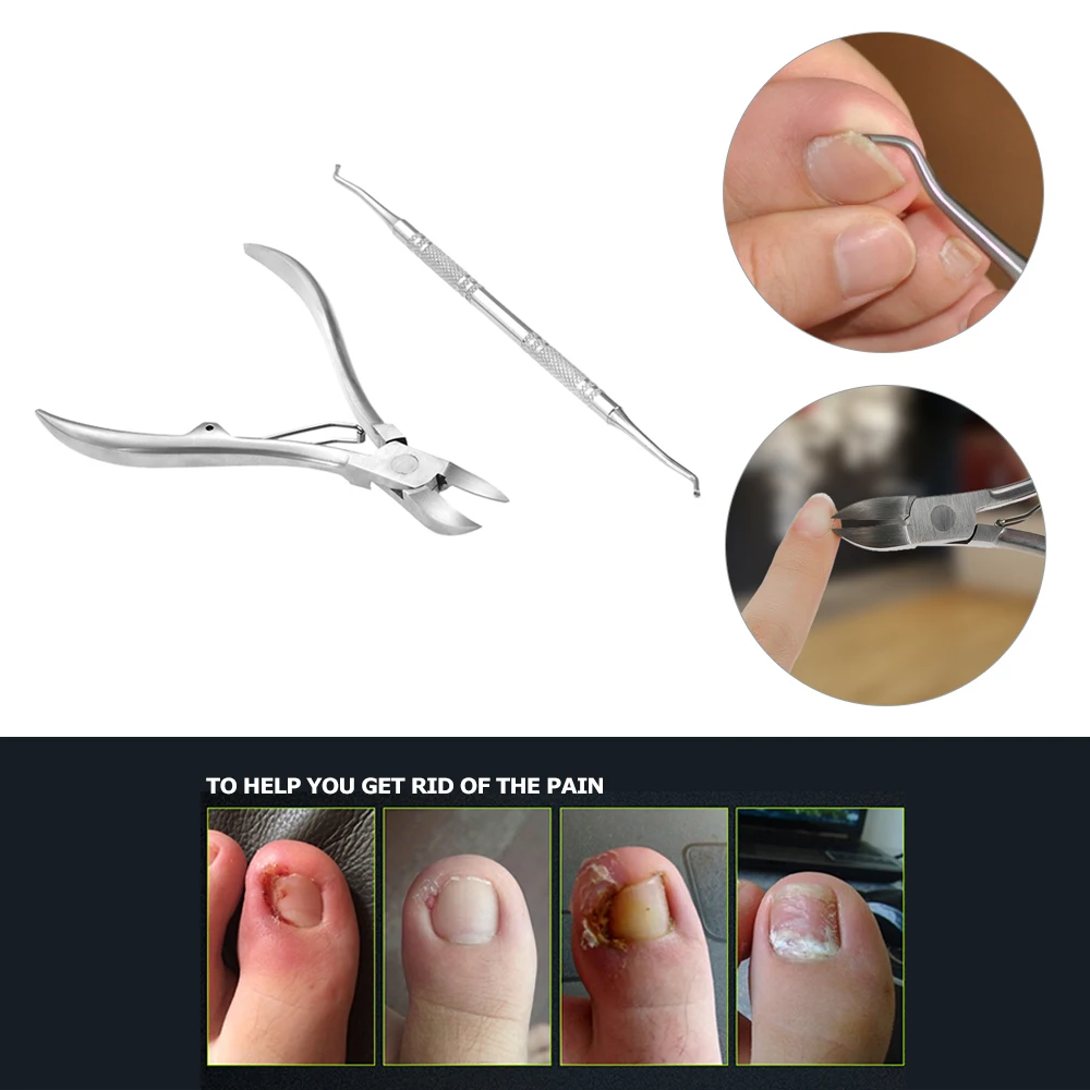 2 шт. для маникюра и педикюра инструмент Нержавеющая сталь ногтей ножницы для кутикулы + вросший очиститель для педикюра ногтей кусачки для