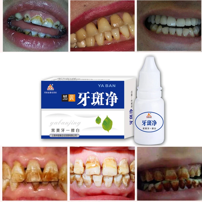 

10ml Teeth Whitening Water Oral Hygiene Cleaning Teeth Care Tooth Cleaning Whitening Water Clareamento Dental Odontologia