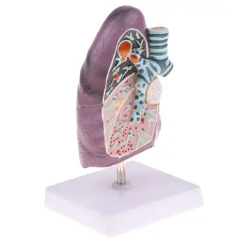 

2: 3 Lung Pathological Model Structure Human Organ Anatomical Model for School Teaching Tool Learning Display Lab Supplies